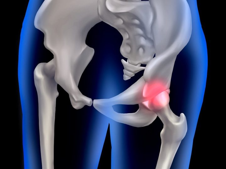 Klára – Režimová opatření po TEP